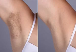 Normal Wax – Underarms